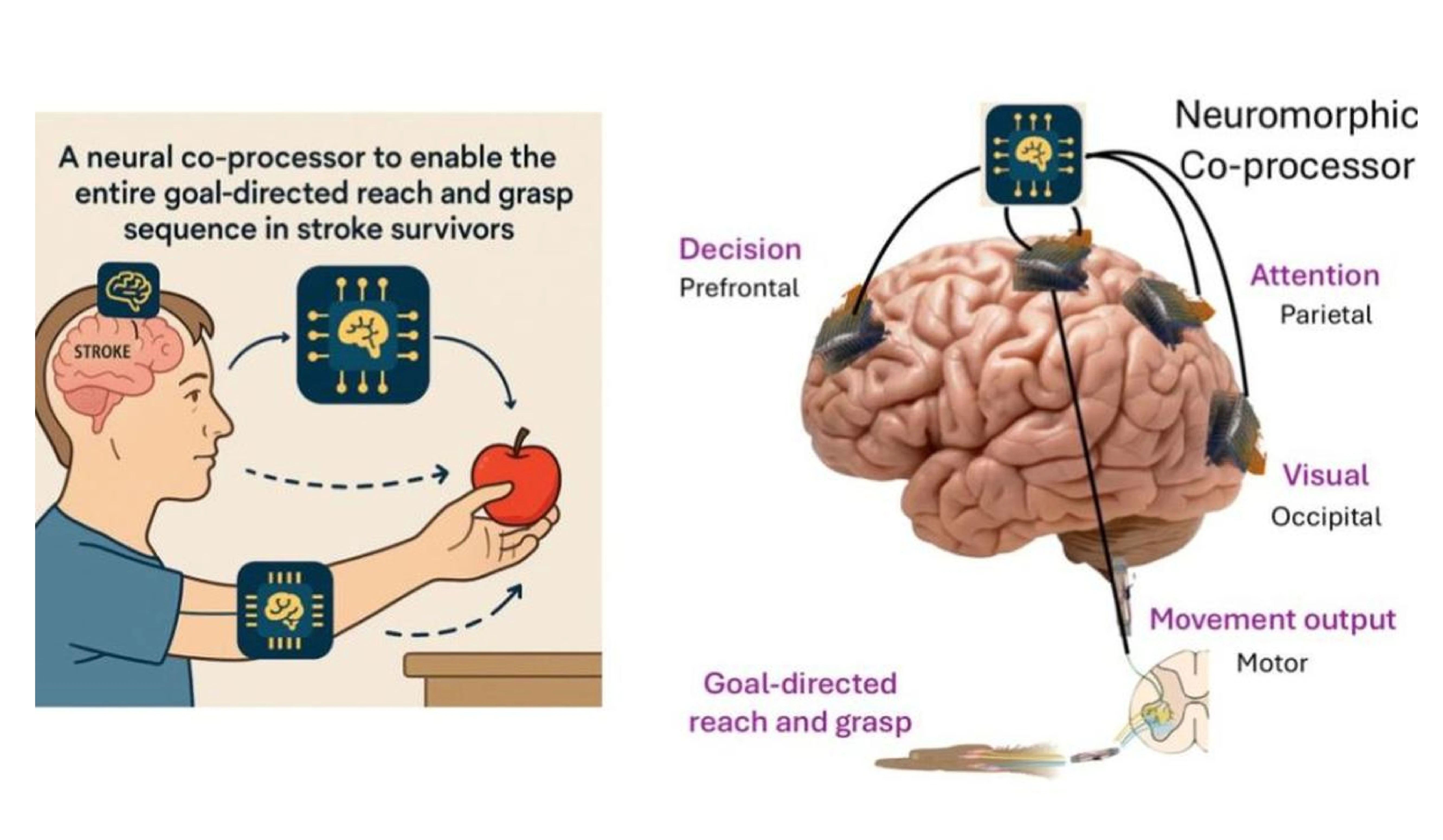 Non-invasive Brain Stimulation and Co-processors